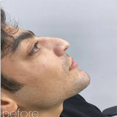قبل